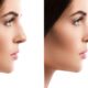 urgence chirurgie nez
